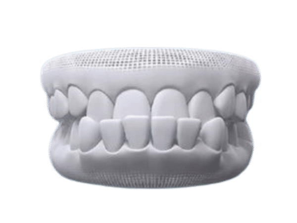 Khớp cắn ngược